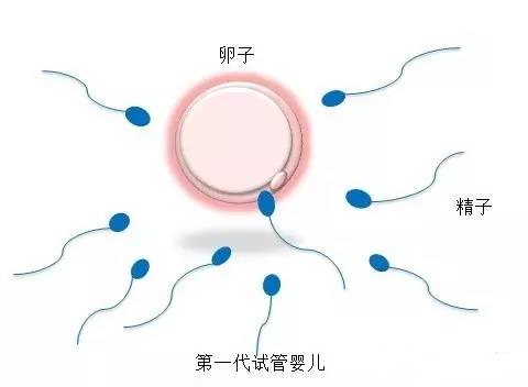 凍結胚移植